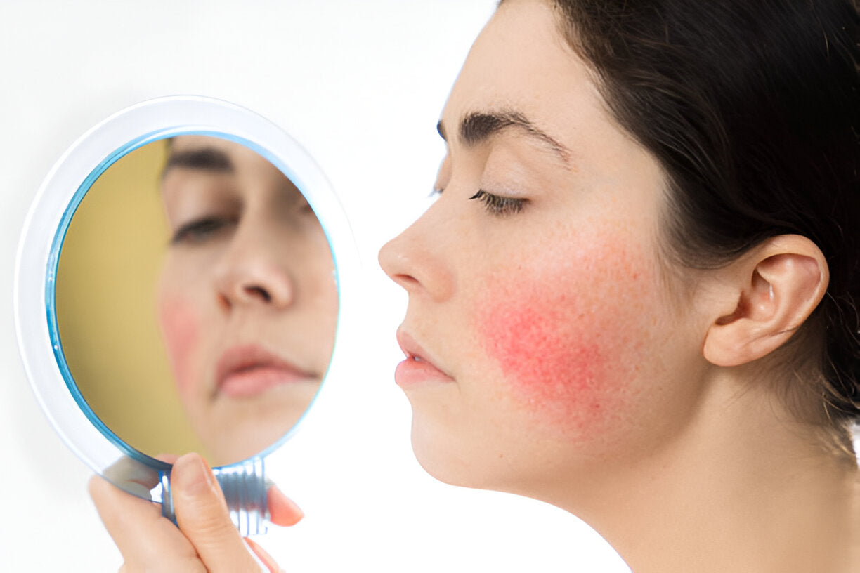 Sanfte Pflege für empfindliche Haut | Wonder Skin Deutschland