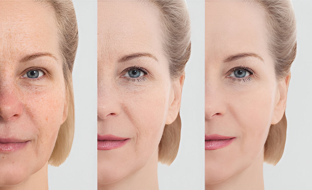 Anti-Aging Hautpflege entdecken | Wonder Skin Deutschland