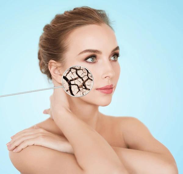 Hautpflege bei Trockenheit | Wonder Skin Deutschland