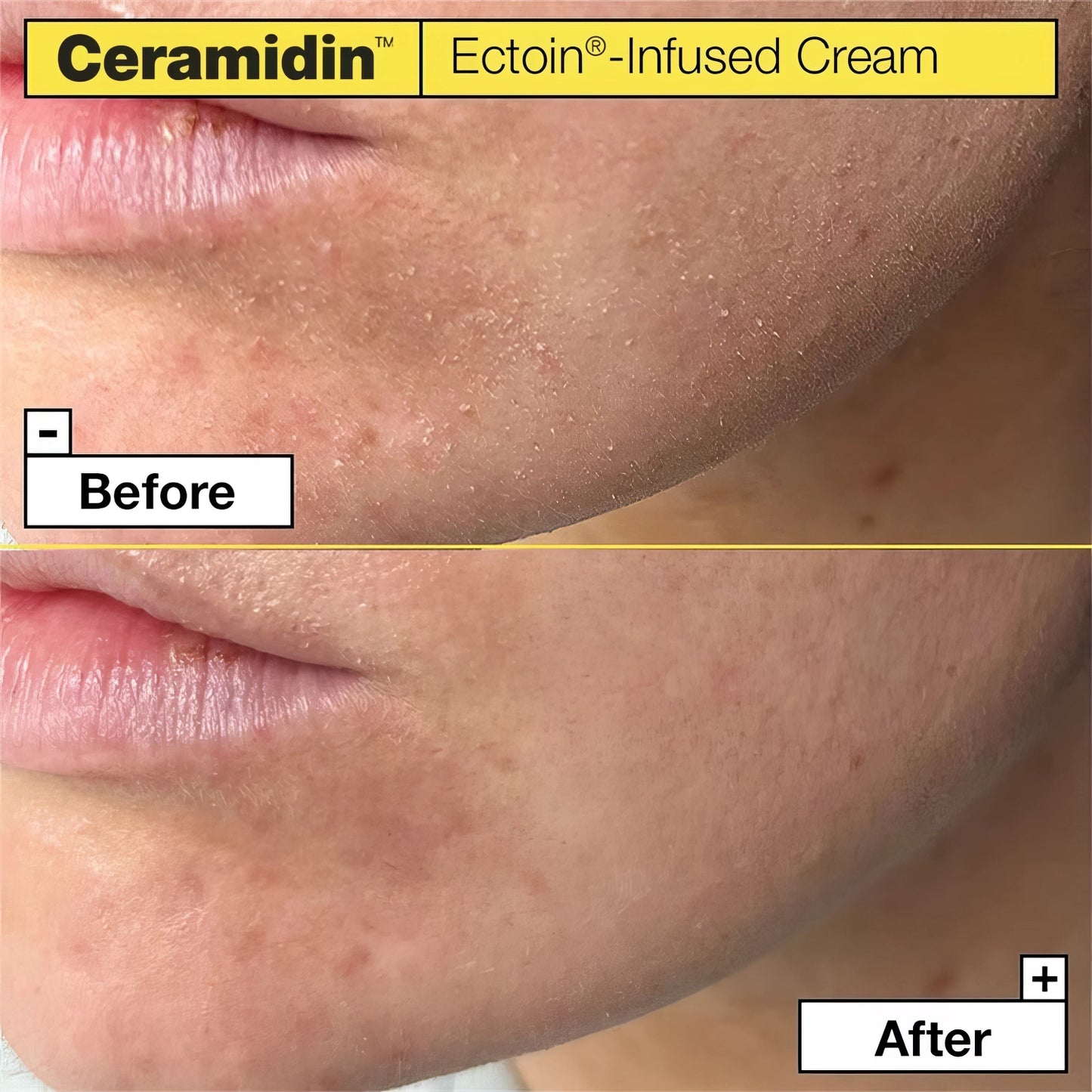 Dr.Jart+ - Ceramidin Ectoin-Infused Cream - 50ml-Wonder Skin